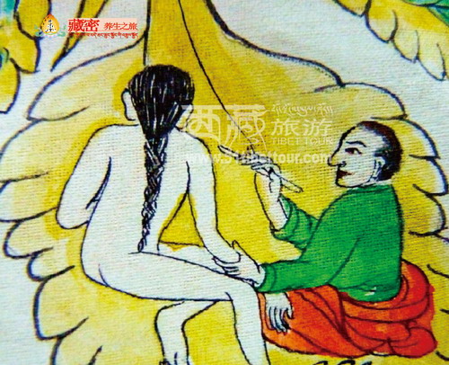 藏医放血疗法